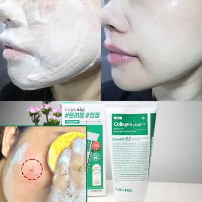 대용량 좁쌀 여드름 올리브영 약산성 클렌징폼 클렌저